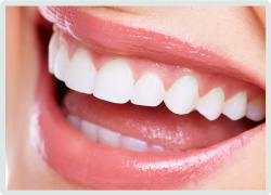 みがいても取れない歯の黄ばみはホワイトニングで除去しましょう。